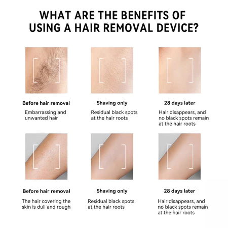 LESCOLTON  Hair Removal Painless IPL Home Pulsed Light with LCD Display