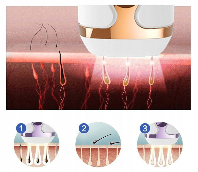 IPL Laser Hair Removal Machine - choicemall