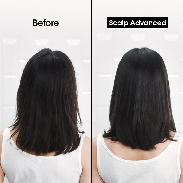 Loreal Professionnel Serie Expert Scalp Advanced Anti-Oiliness Shampoo 300ml