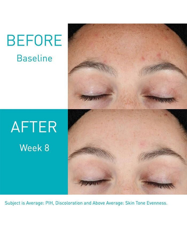 Cerave Resurfacing Retinol Serum - Choicemall